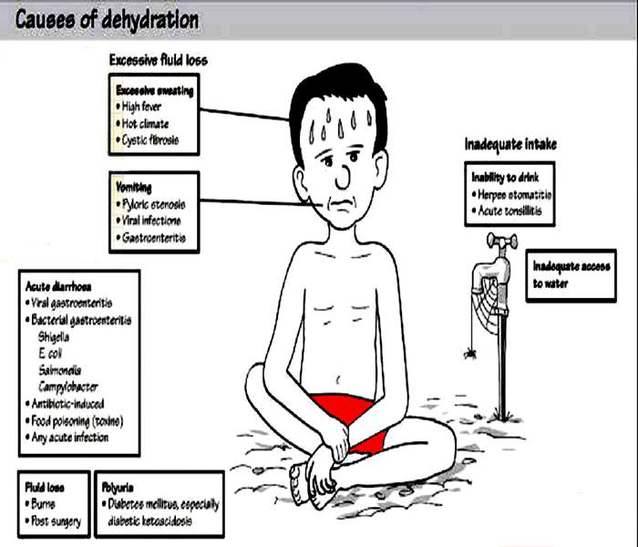 What are the causes of dehydration?