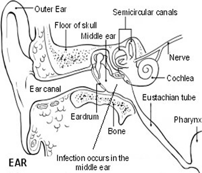 Ear Infections