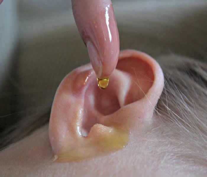 Ear Infections