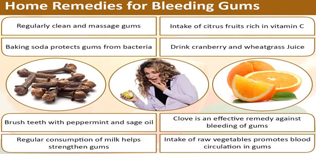 Bleeding gums
