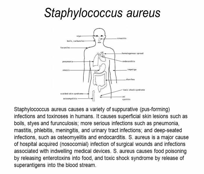 Staphylococcuss