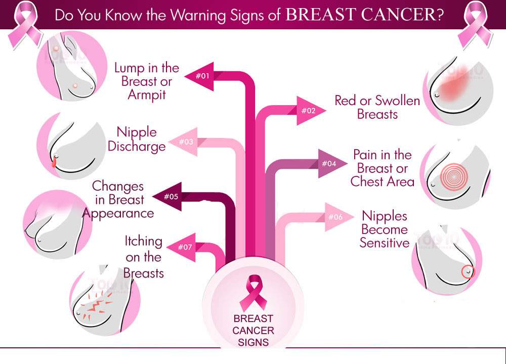 Breast Cancer