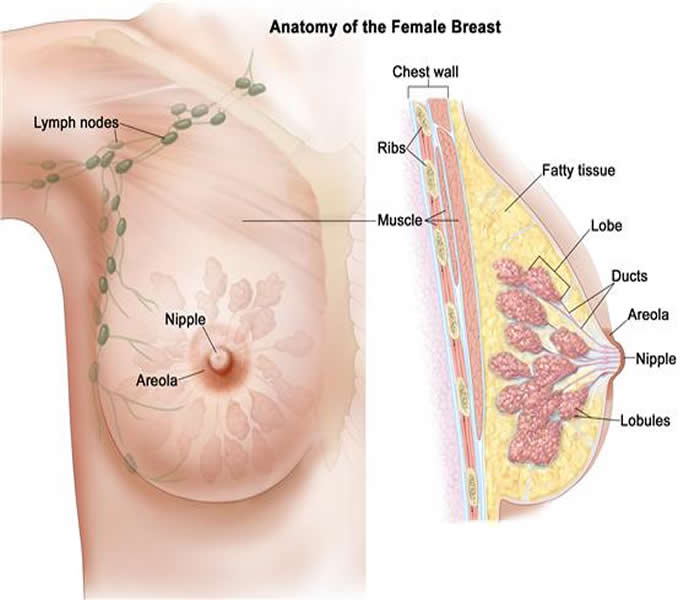 Breast Cancer