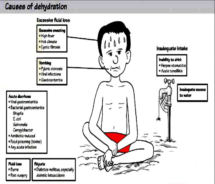 Dehydration - Causes, Symptoms, Treatment, Diagnosis and Prevention :: Galleria Community and Lifestyle, Nigeria