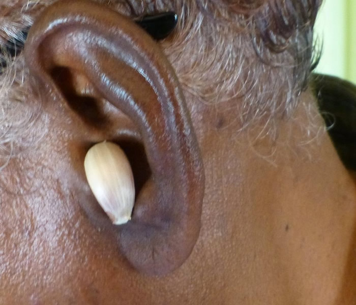 How to Treat Ear Infections from Home How to Treat Ear Infections from Home : BusinessHAB.com
