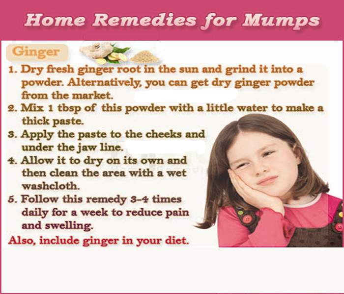 Natural remedies for mumps