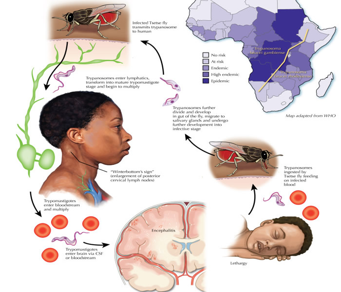 sleeping-sickness