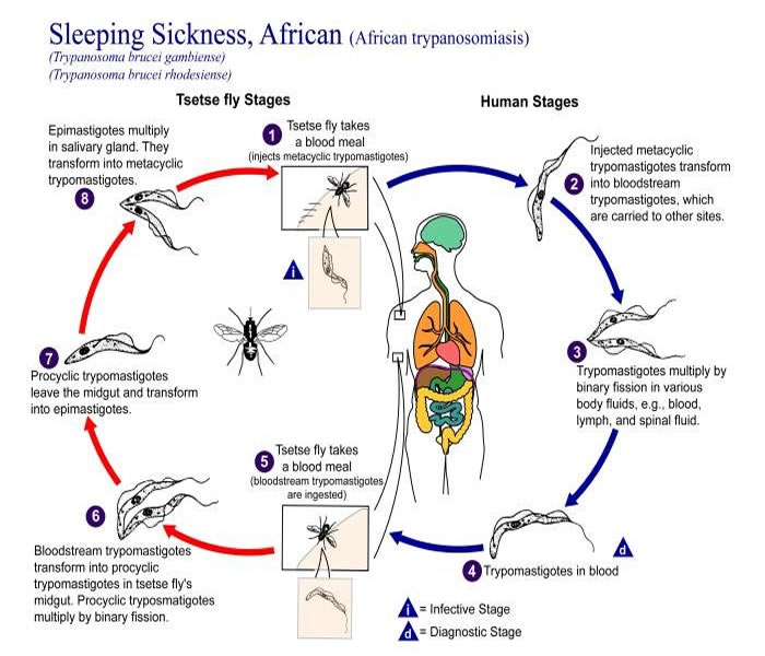 sleeping-sickness