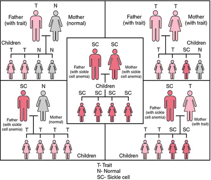 sickle-cell