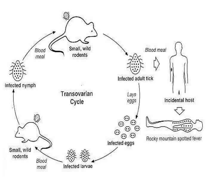 Typhus