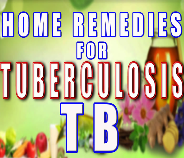 Tuberculosis